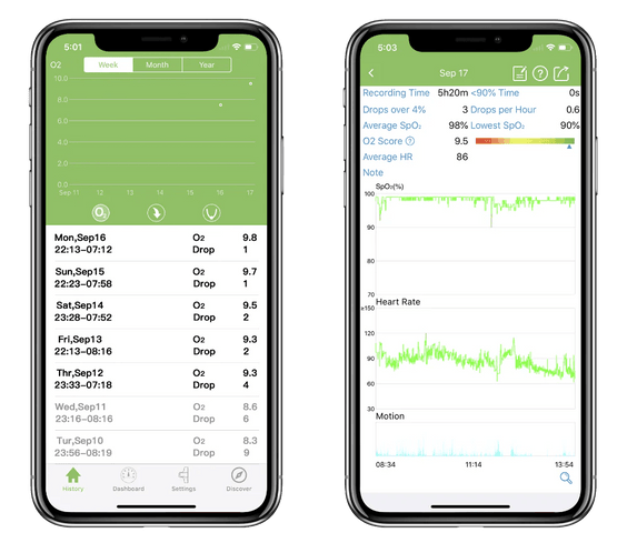 Kid's O2Ring Children’s Oxygen Monitor | Sleep Tracker for Kids | Australia KidsO2™ O2 Ring - TipTop Health