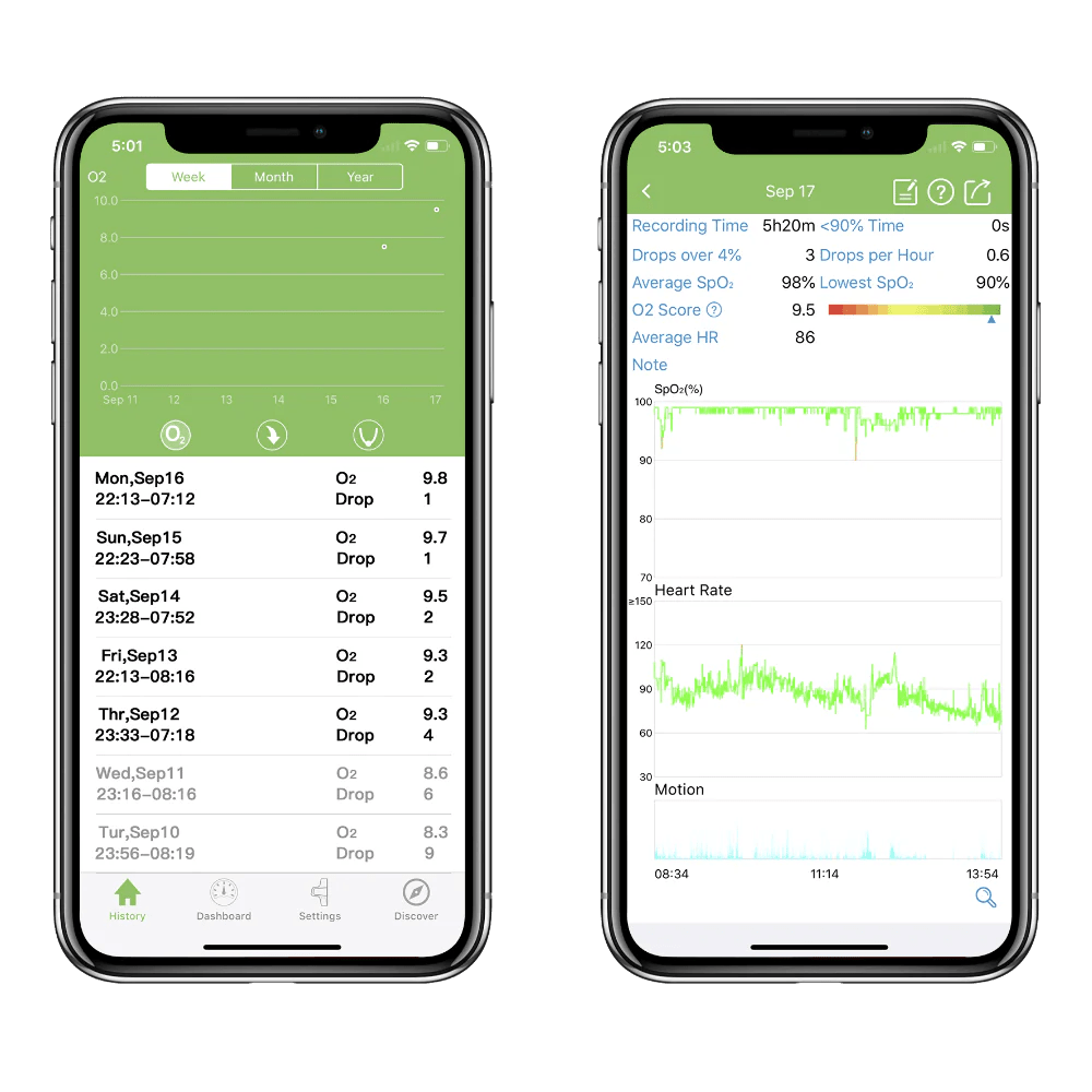 Kid's O2Ring Children’s Oxygen Monitor | Sleep Tracker for Kids | Australia KidsO2™ O2 Ring - TipTop Health